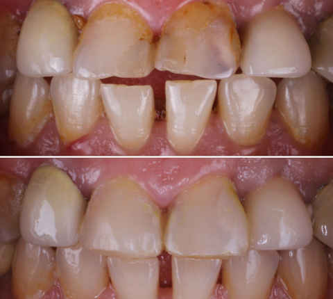 Before / After Treatment