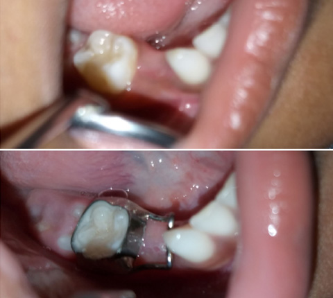Before / After Treatment